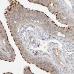 CEP162 Antibody in Immunohistochemistry (IHC)
