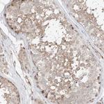 CEP162 Antibody in Immunohistochemistry (IHC)