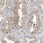 CEP162 Polyclonal Antibody