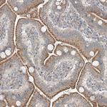 CEP162 Polyclonal Antibody