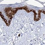 FRS3 Antibody in Immunohistochemistry (IHC)