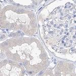FRS3 Antibody in Immunohistochemistry (IHC)