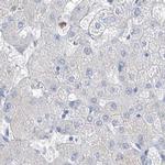 FRS3 Antibody in Immunohistochemistry (IHC)