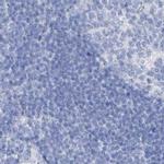 FRS3 Antibody in Immunohistochemistry (IHC)