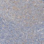 MICAL1 Polyclonal Antibody