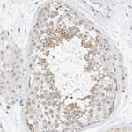 MICAL1 Polyclonal Antibody