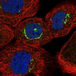 ZNF25 Polyclonal Antibody