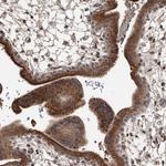 ZNF25 Antibody in Immunohistochemistry (Paraffin) (IHC (P))