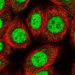 ZIC4 Polyclonal Antibody