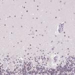 ZIC4 Antibody in Immunohistochemistry (Paraffin) (IHC (P))