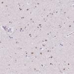 ZIC4 Antibody in Immunohistochemistry (Paraffin) (IHC (P))