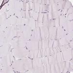 ZIC4 Antibody in Immunohistochemistry (Paraffin) (IHC (P))
