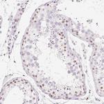 ZIC4 Antibody in Immunohistochemistry (Paraffin) (IHC (P))