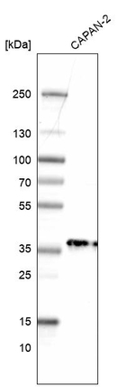 PDXK Antibody in Western Blot (WB)