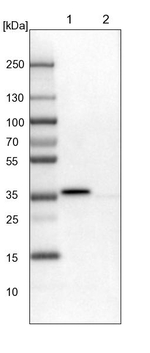 PDXK Antibody in Western Blot (WB)