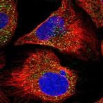 AGPS Polyclonal Antibody