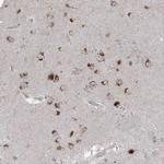 AGPS Antibody in Immunohistochemistry (Paraffin) (IHC (P))