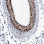 AGPS Polyclonal Antibody