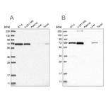 AGPS Antibody in Western Blot (WB)