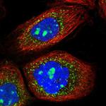 AGPS Polyclonal Antibody