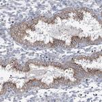 AGPS Antibody in Immunohistochemistry (Paraffin) (IHC (P))