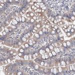 AGPS Antibody in Immunohistochemistry (Paraffin) (IHC (P))