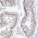 AGPS Antibody in Immunohistochemistry (Paraffin) (IHC (P))