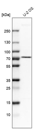 AGPS Antibody in Western Blot (WB)