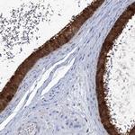 C6orf115 Antibody in Immunohistochemistry (IHC)