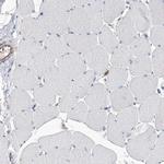 C6orf115 Antibody in Immunohistochemistry (IHC)