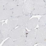 PSMB10 Antibody in Immunohistochemistry (Paraffin) (IHC (P))