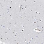 PSMB10 Antibody in Immunohistochemistry (IHC)