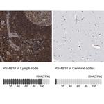 PSMB10 Antibody