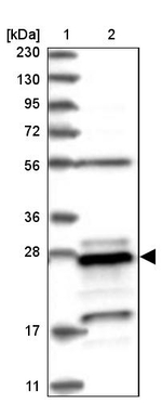 PSMB10 Antibody in Western Blot (WB)