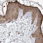 ZNF710 Antibody in Immunohistochemistry (IHC)