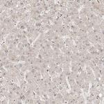 ZNF710 Antibody in Immunohistochemistry (IHC)