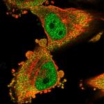 MTO1 Polyclonal Antibody