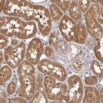 MTO1 Antibody in Immunohistochemistry (Paraffin) (IHC (P))