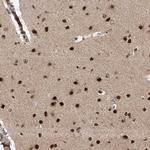 ZNF280D Antibody in Immunohistochemistry (Paraffin) (IHC (P))