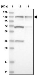 ZNF280D Antibody in Western Blot (WB)