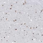 LIN9 Antibody in Immunohistochemistry (Paraffin) (IHC (P))