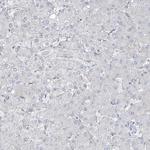 LIN9 Antibody in Immunohistochemistry (Paraffin) (IHC (P))