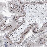 LIN9 Antibody in Immunohistochemistry (Paraffin) (IHC (P))