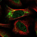 Rhotekin Polyclonal Antibody