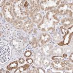 Rhotekin Antibody in Immunohistochemistry (IHC)