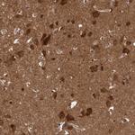 DIP2C Polyclonal Antibody