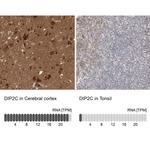 DIP2C Antibody in Immunohistochemistry (IHC)