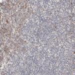 DIP2C Antibody in Immunohistochemistry (IHC)