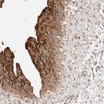 CCL14 Polyclonal Antibody