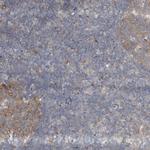 AKNAD1 Polyclonal Antibody